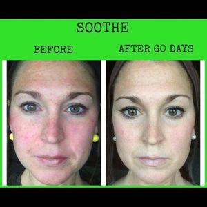 Rodan + Fields Soothe Regime for sensitive skin